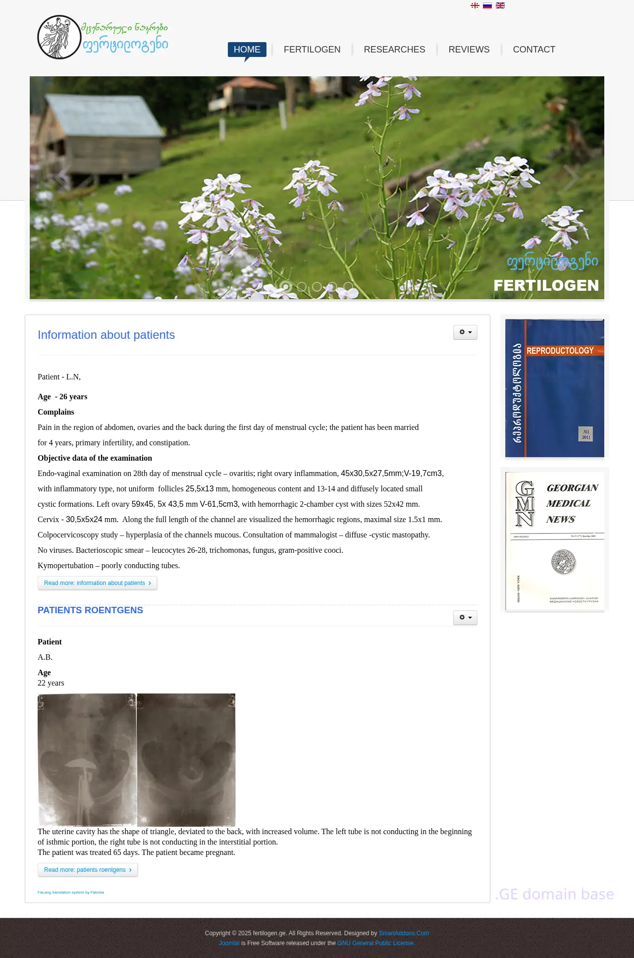 Screenshot of the site fertilogen.ge